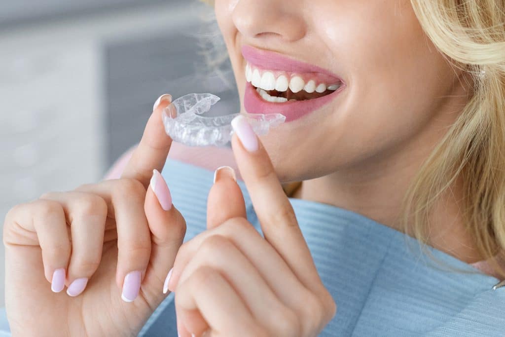 Could I Be a Candidate for Clear Aligners